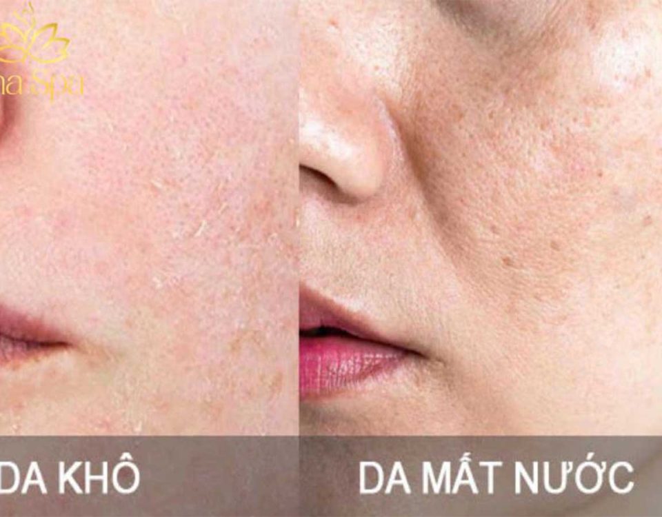 làn da khô