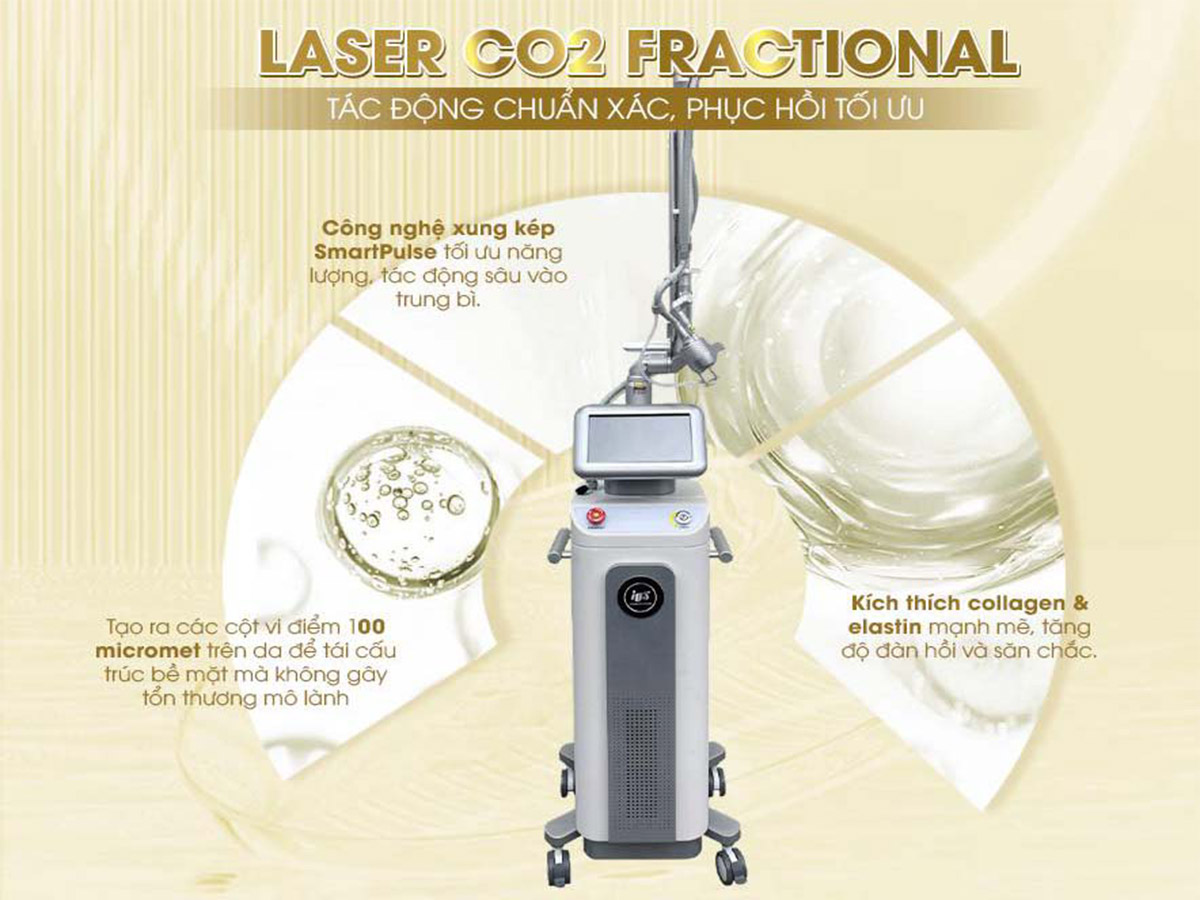 máy công nghệ spa 2026