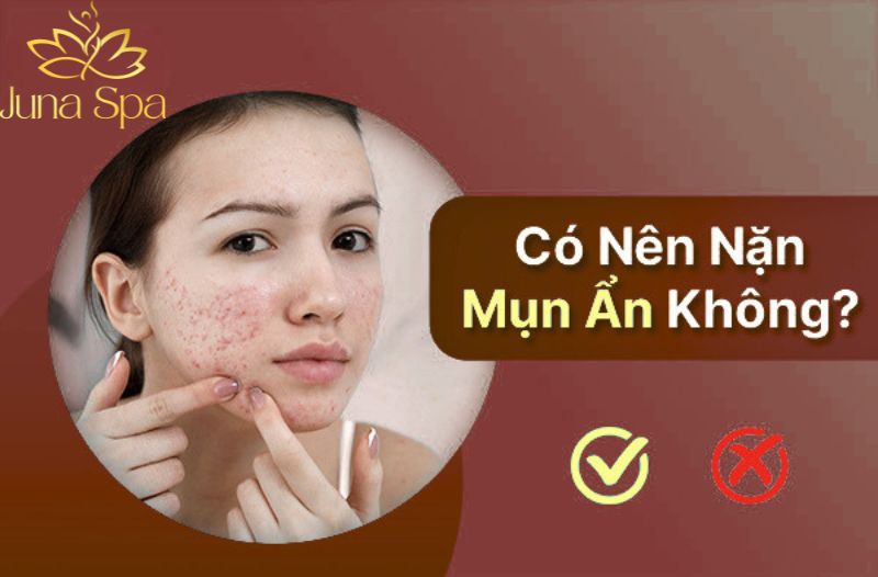 Nặn mụn ẩn có cần thiết không và cách chăm sóc da đúng cách