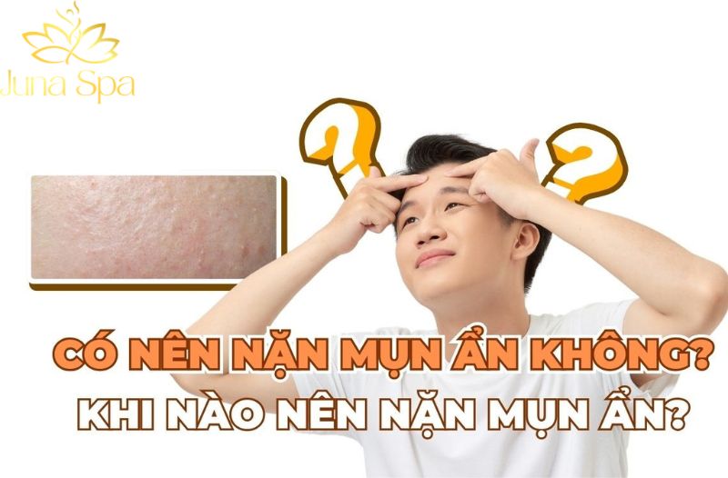 Nặn mụn ẩn có thực sự cần thiết không