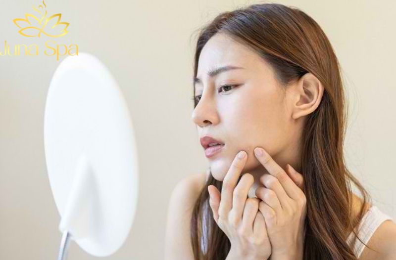 Tần suất lấy mụn như thế nào là hợp lý