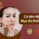 có nên nặn mụn ẩn không banner