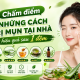Chấm điểm những cách trị mụn tại nhà hiệu quả sau 1 đêm trên mạng
