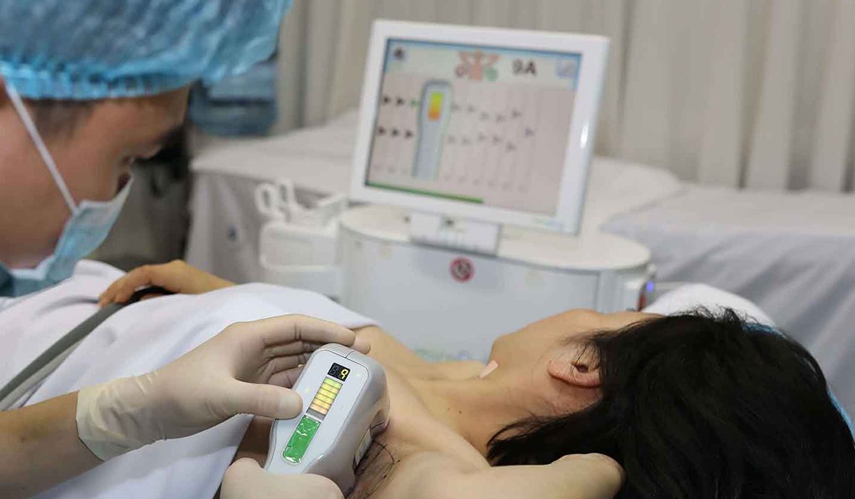 Top công nghệ trị hôi nách mới nhất 2026: Đâu là phương pháp hiệu quả?