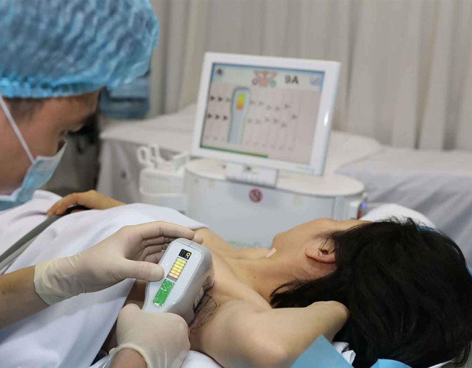 Top công nghệ trị hôi nách mới nhất 2026: Đâu là phương pháp hiệu quả?