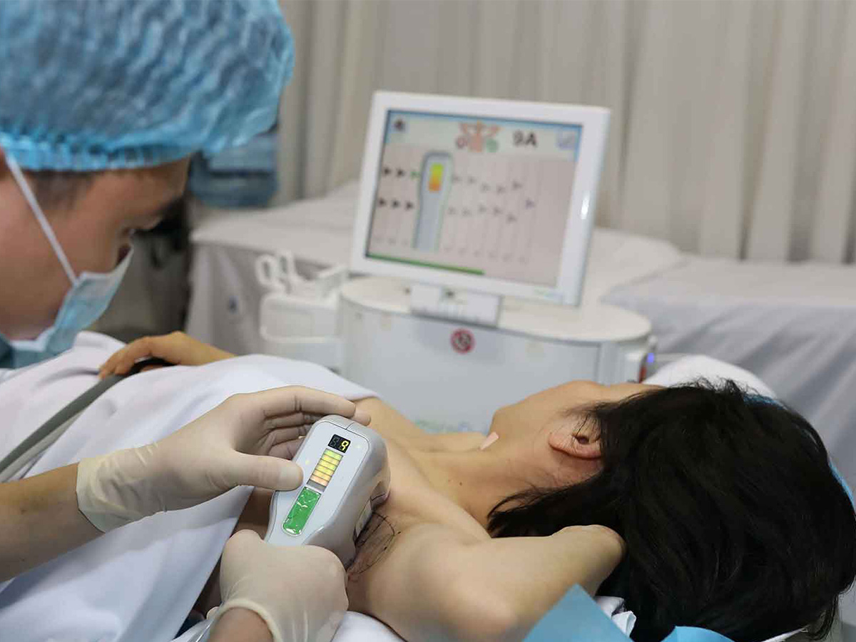 Top công nghệ trị hôi nách mới nhất 2026: Đâu là phương pháp hiệu quả?